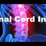 Finding the Right Spinal Cord Injury Lawyer