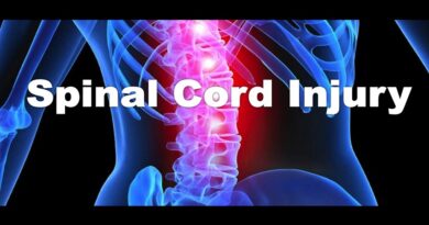 Finding the Right Spinal Cord Injury Lawyer